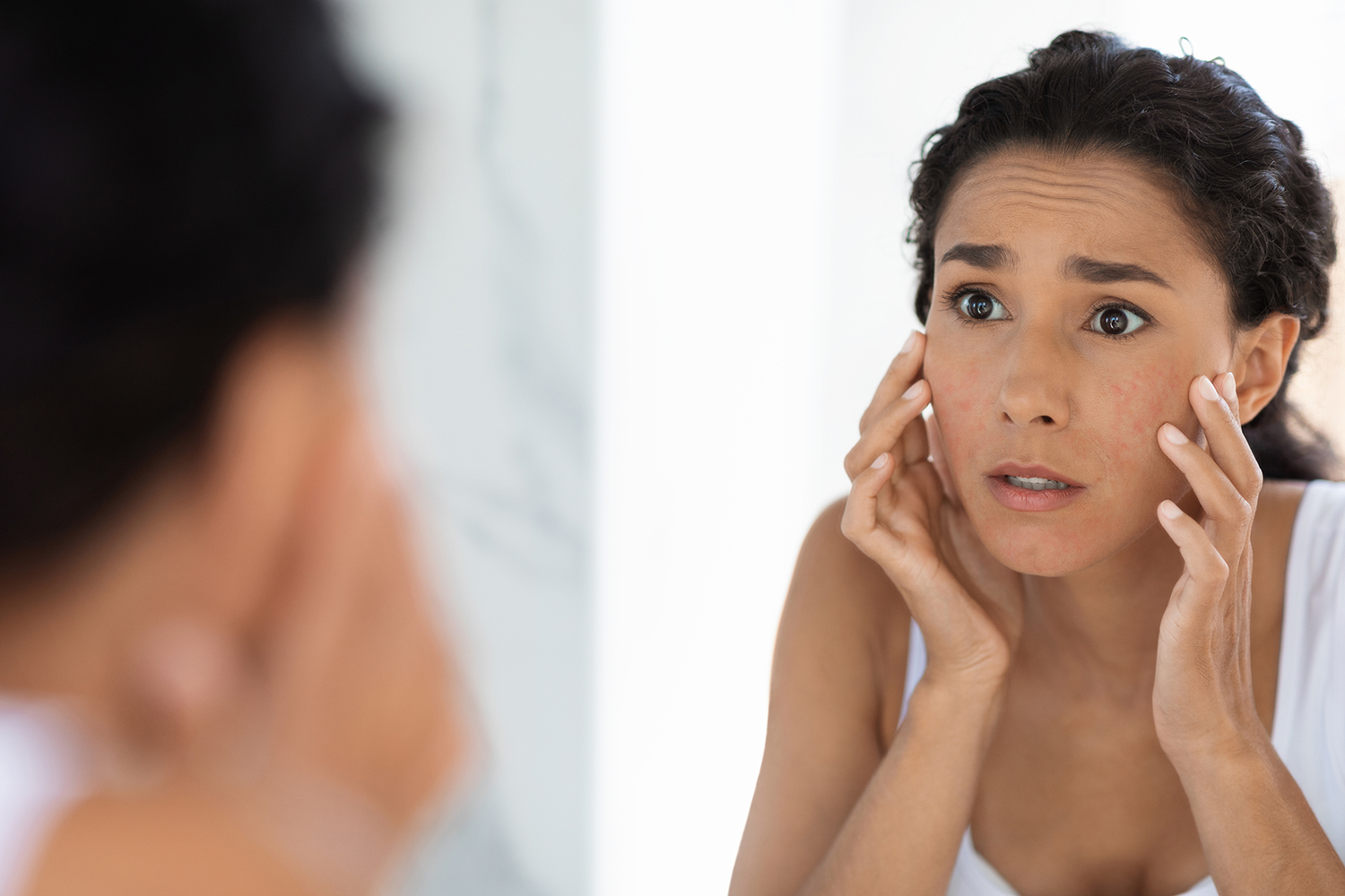 Eine Frau sieht sich im Spiegel besorgt ihre Neurodermitis auf ihren Wangen an.
