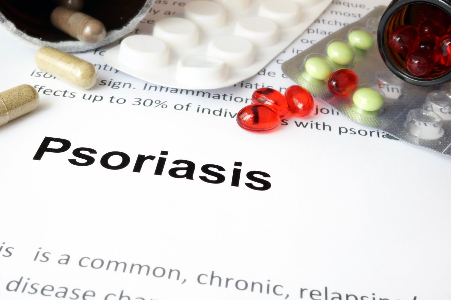 Tabletten auf einem Stapel Papier, auf dem Psoriasis steht. Thema: Therapien bei Psoriasis